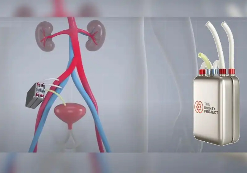 Rim bioartificial, desenvolvido na Univrsidade da Califórnia, EUA, será testado agora em humanos - Foto: UCSF / The Kidney Project